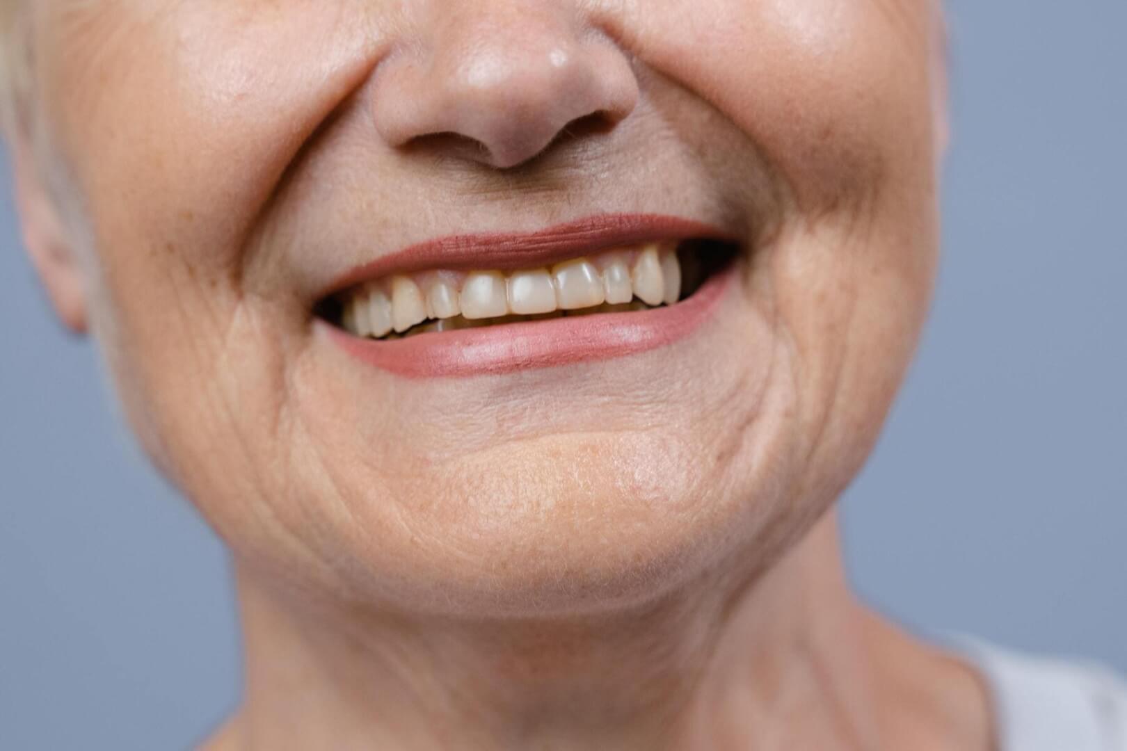 Una mujer mayor sonriendo en un plano detalle de su boca y nariz. 