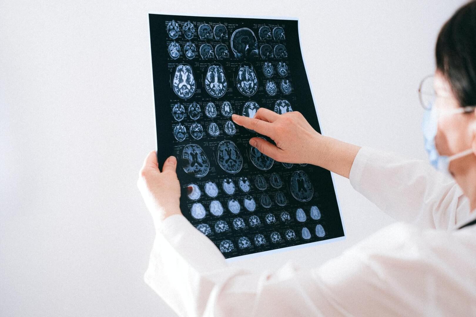 Una doctora examina una radiografía de un cerebro. 