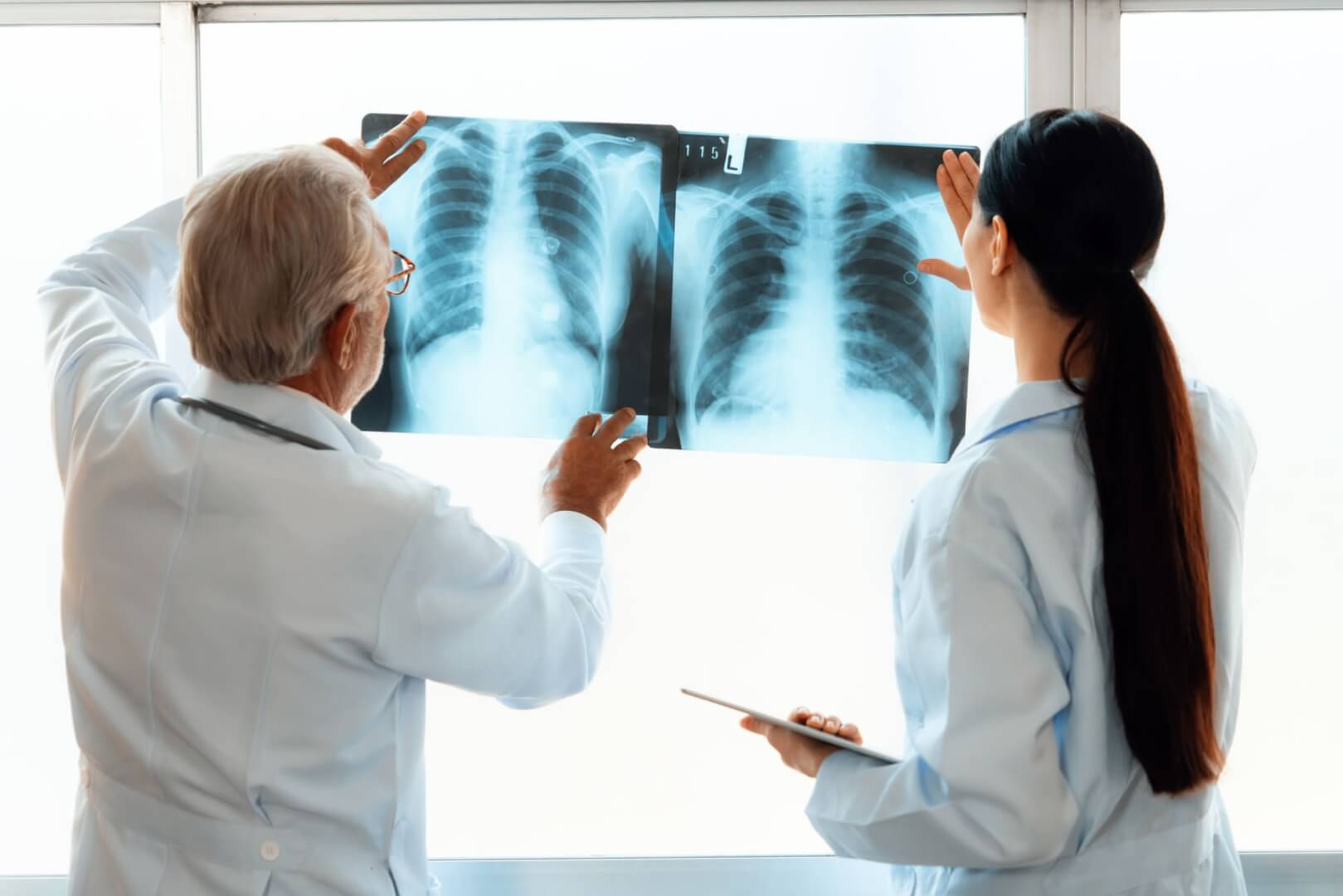 Un doctor examina una radiografía de dos pulmones. 