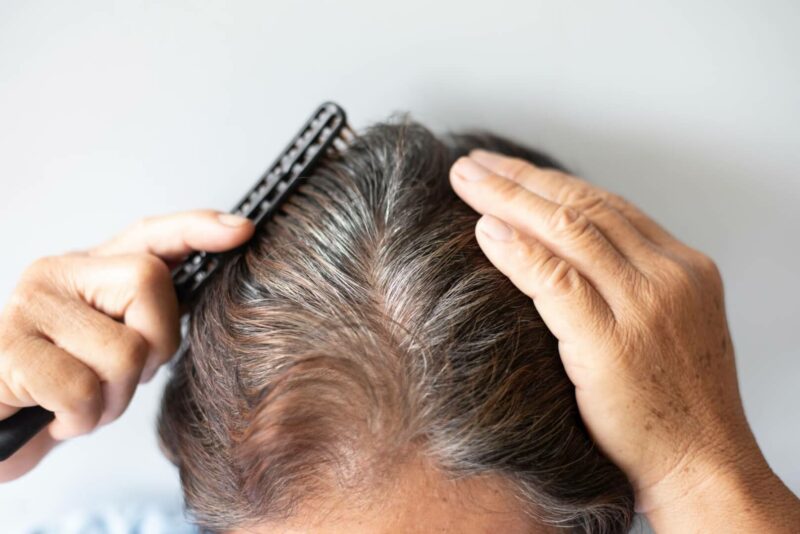 Una mujer mayor se peina con un cepillo la cabeza.