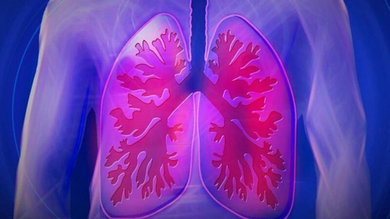 cual es la diferencia entre neumonia y pulmonia